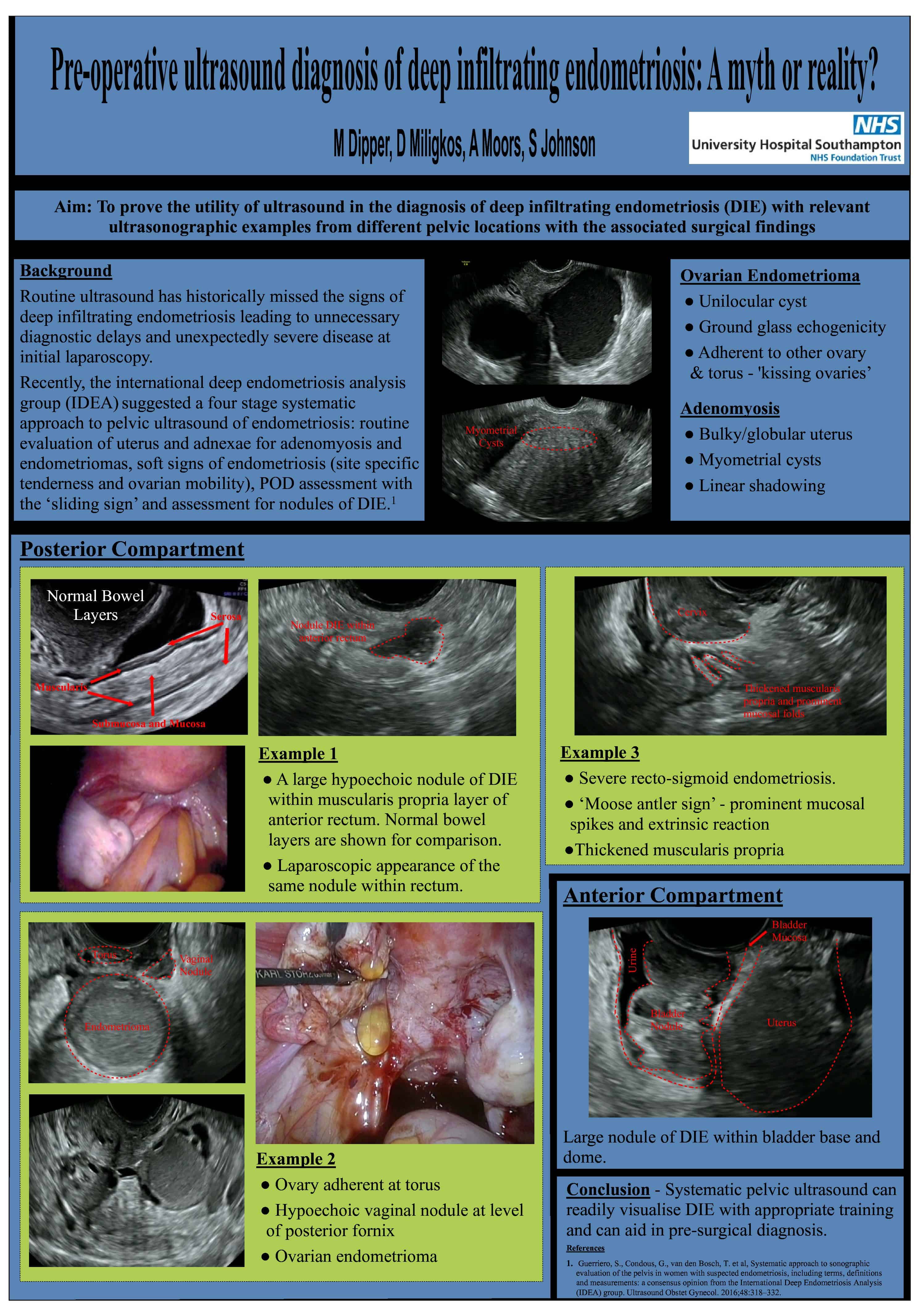 Adolescent gynaecological laparoscopy-A clinical conundrum?