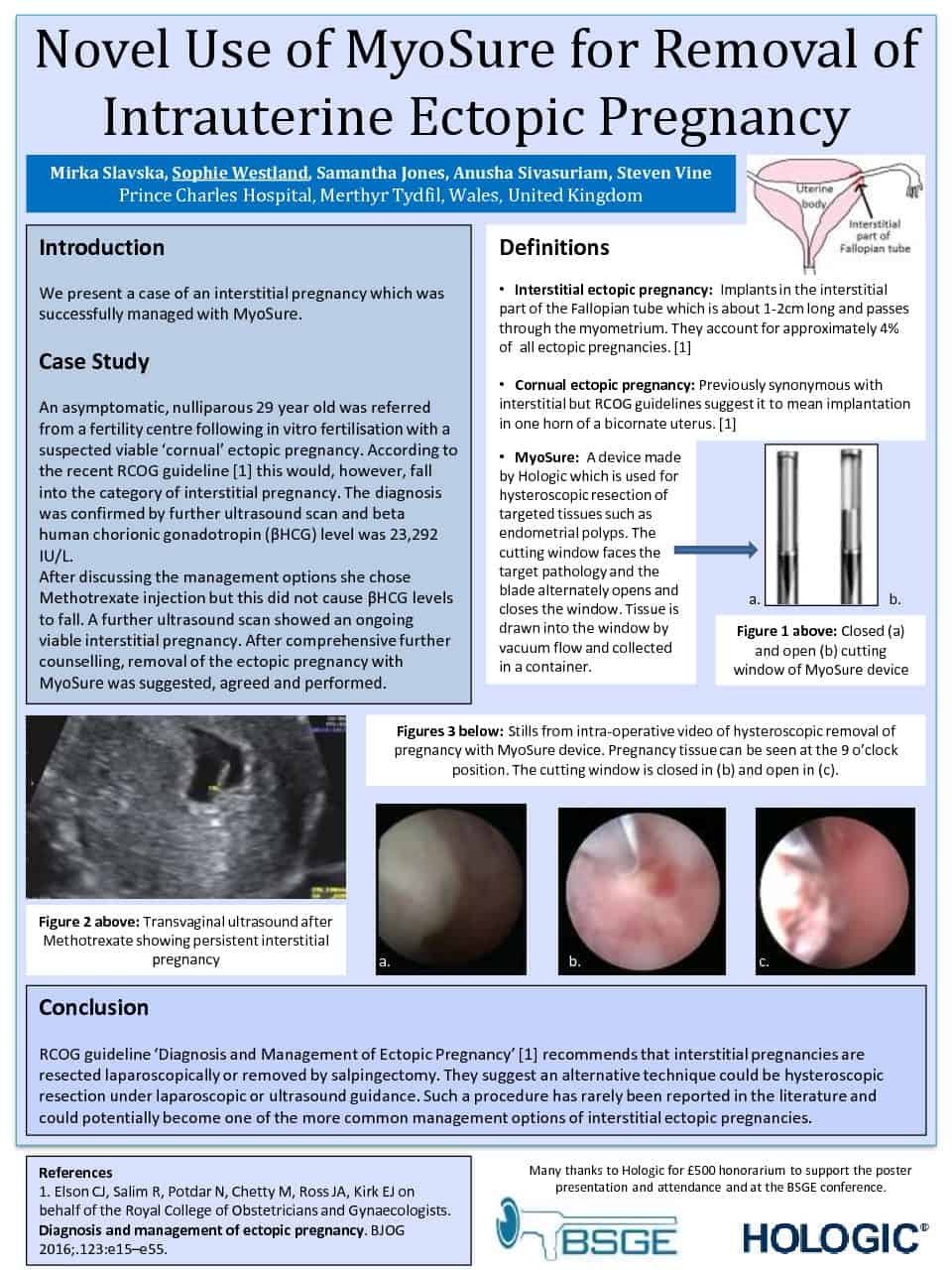 Novel use of MySure for Removal of Intrauterine Ectopic Pregnancy
