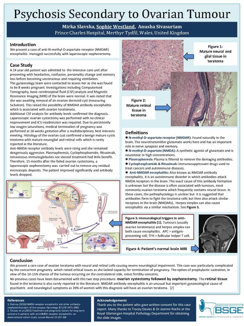 Psychosis Secondary to Ovarian Tumour