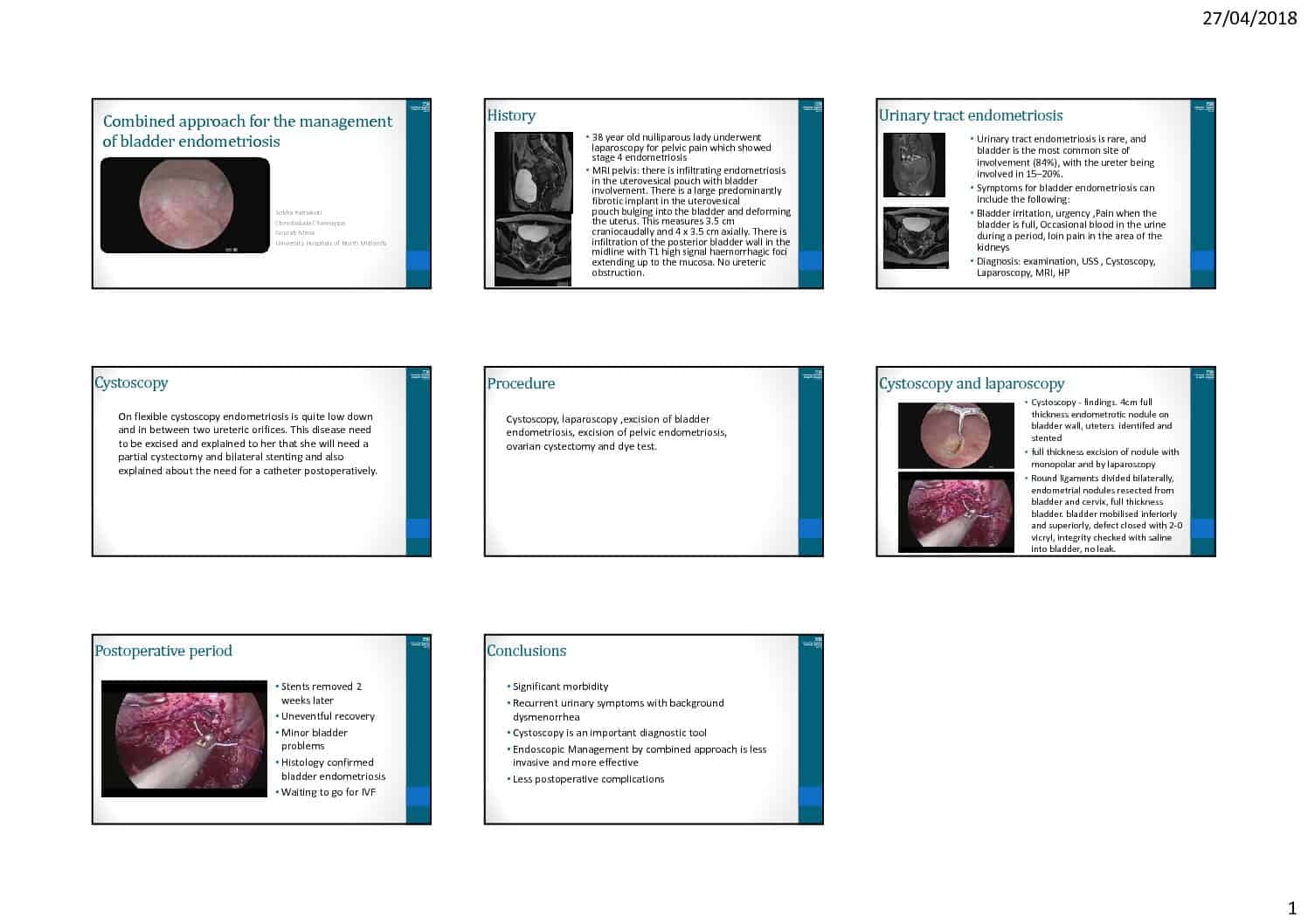 Combined approach for the management of bladder endometriosis