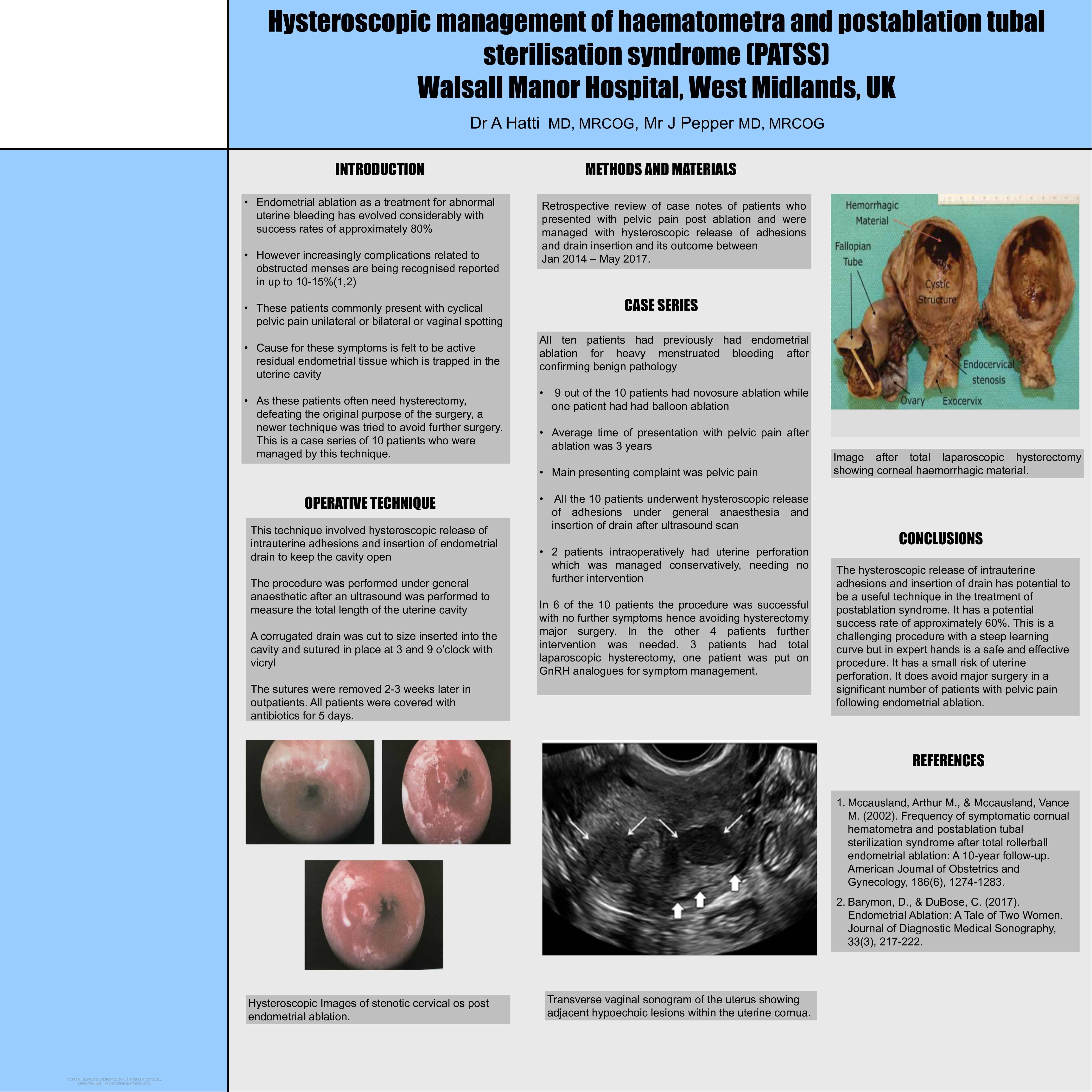 HYSTEROSCOPIC MANAGEMENT OF RETAINED PRODUCTS OF CONCEPTION IN AN  OUTPATIENT SETTING