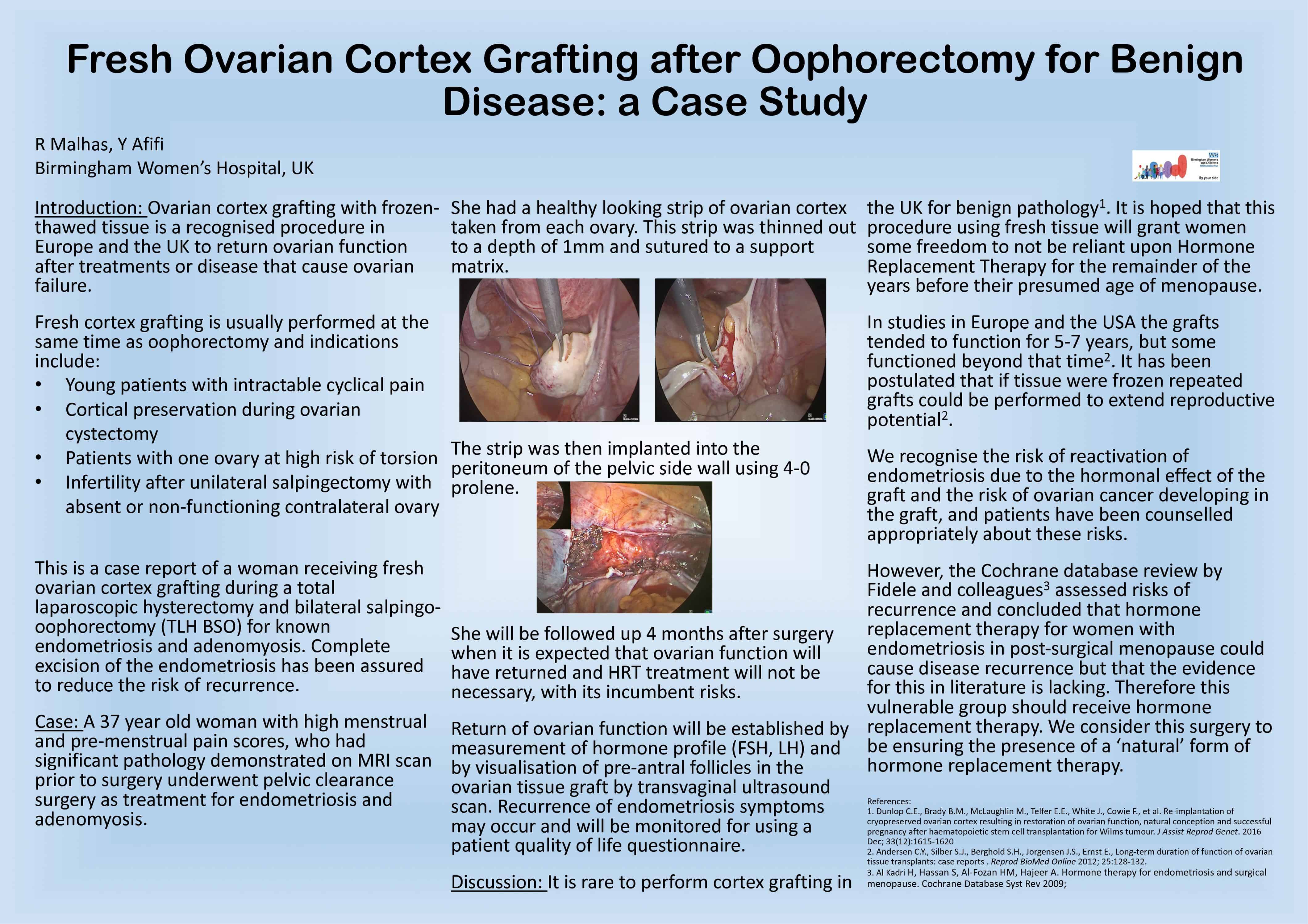 Fresh ovarian cortex graft after oophorectomy for benign disease: a case study