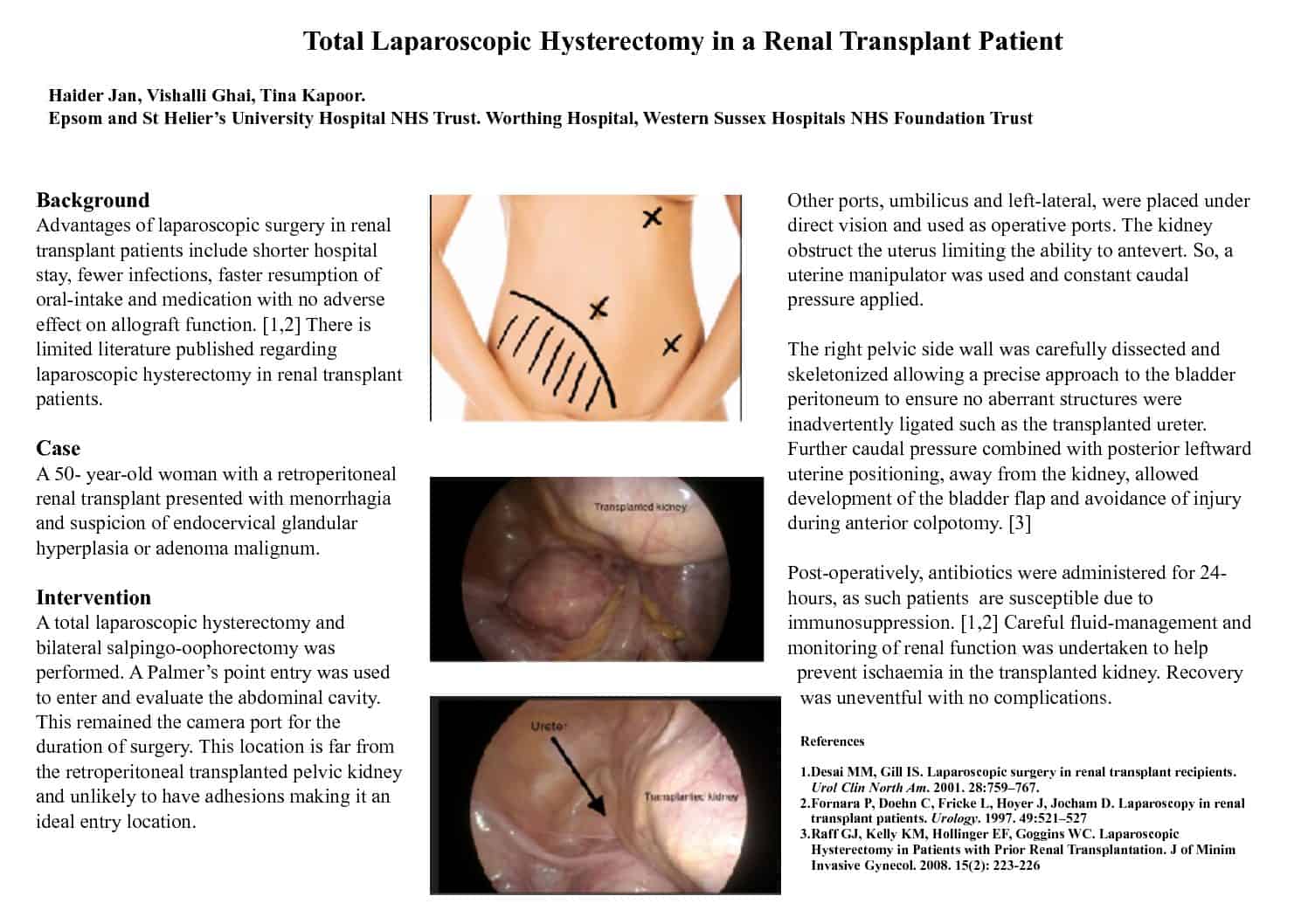 Total Laparoscopic Hysterectomy in a Renal Transplant Patient